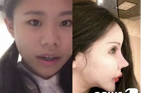 Pelaku melancarkan aksinya di sebuah lapangan setelah mencekoki miras. 'Saya Tidak Akan Pernah Puas dengan Penampilan Saya' Kisah ...