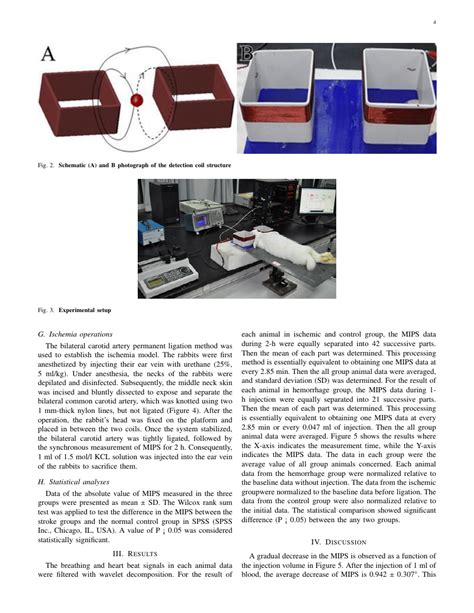 The reference list is usually at the end of your document. IEEE format - For Authors