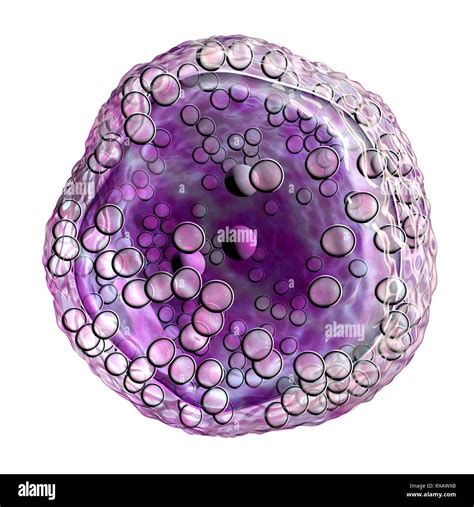 Burkitts Lymphoma Cells Illustration Stock Photo Alamy