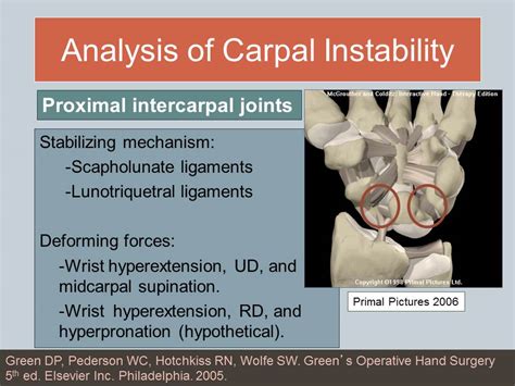 Understanding Wrist Instability Ann Porretto Loehrke Sports Orthopedics