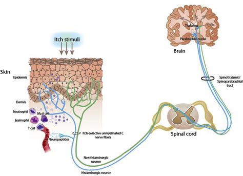 Chronic Itch Management Therapies Beyond Those Targeting The Immune