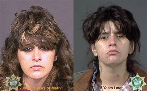 Meth Addicts Before And After 38 Pics Picture 2