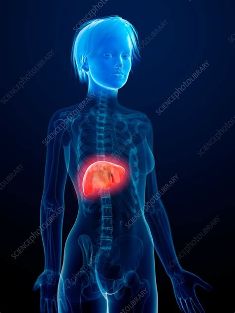 Illustration Of An Inflamed Liver Stock Image F0234555 Science