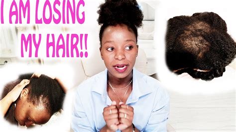 Hair shedding is part of a natural balance — some hairs fall out while others grow in. NATURAL HAIR JOURNEY 4C HAIR / MY HAIR IS FALLING OUT ...