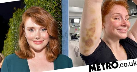 Bryce Dallas Howard Shows Off Bruises While Filming For Jurassic World Metro News
