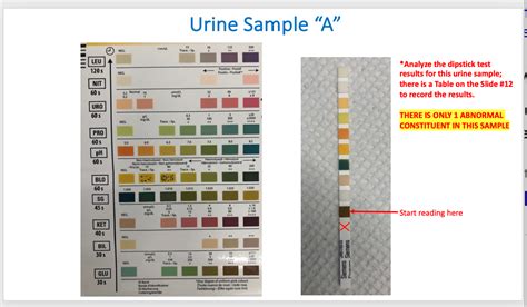 Urine Dipstick Results Sheet