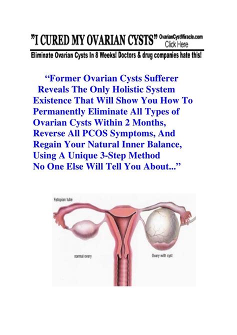 Ovarian Cysts In Pregnancy Pregnancy With Ovarian Cysts Ovarian Cysts Pregnancy