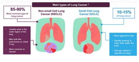 types of non small cell lung cancer