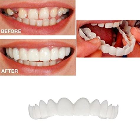 Finme Temporary Tooth Kit Natural Veneer Replace Missing Teeth Cover