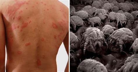 Dust Mites In Your Bed Are Making You Sick This Is How You Kill Them