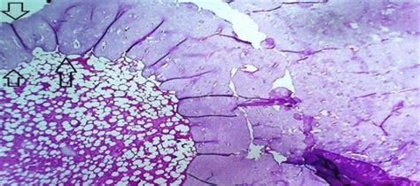 Histological Section Of 4x Of Blue Bone Material Group At 28 Days The