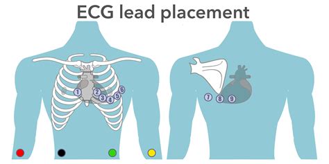 Ecg Placement And Mis Leading Ecgs Uk