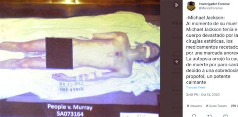 Michael Jacksons Autopsy Revealed Something Chilling