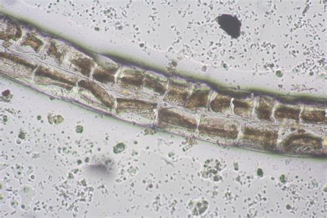 Need Help With Identifying This Filamentous Algae Researchgate