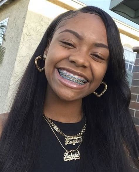 Pin By Lay 🤪‼️ On Braceface Human Hair Extensions Cute Braces