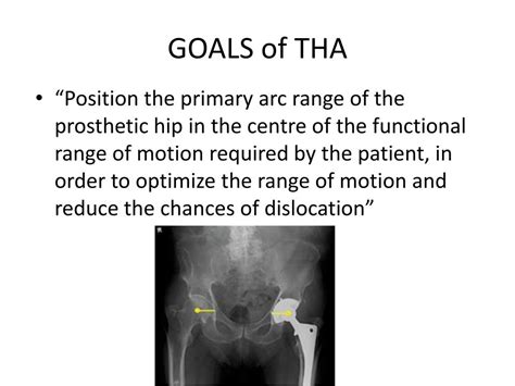 Ppt Primary Total Hip Arthroplasty Powerpoint Presentation Free