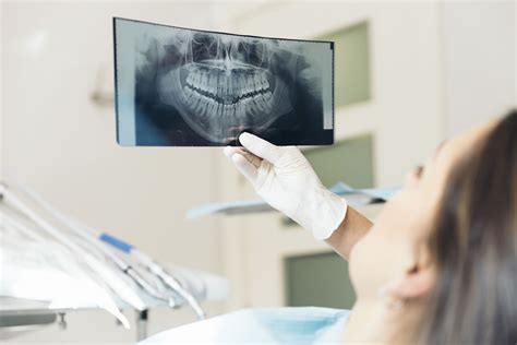 Everything You Need To Know About Dental X Rays From 123dentist