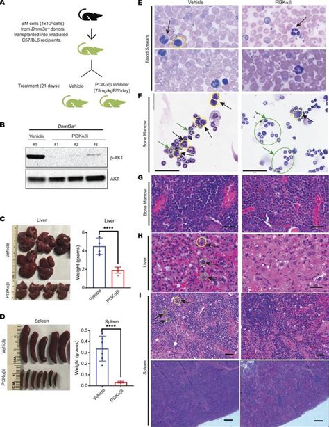 JCI Insight Loss Of Dnmt3a Impairs Hematopoietic Homeostasis And Myeloid Cell Skewing Via The