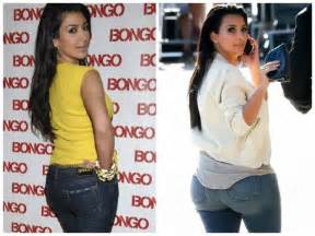 Kim Kardashian Butt Plastic Surgery Before And After