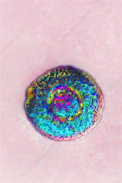Mycoplasma Stock Image C0481007 Science Photo Library