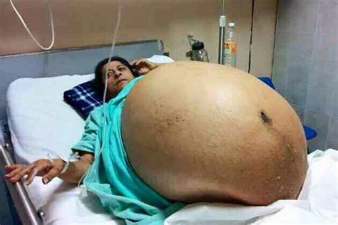 An african woman, gosiame thamara sithole, successfully delivered 10 babies in one birth (decuplets). Articles: June 2015