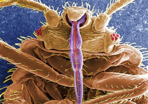 Up Close And Personal A Bedbug Album Live Science