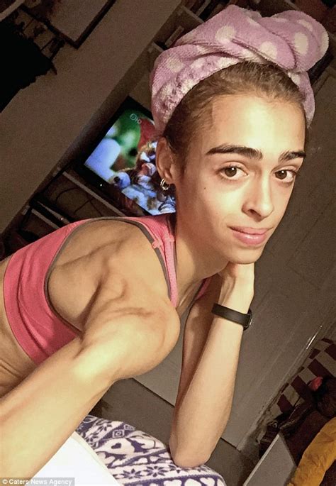 Four Stone Anorexic Ballet Dancer Who Survived On Just 140 Calories A Day After She Was Called