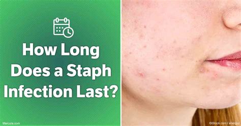 How Long Does A Staph Infection Last