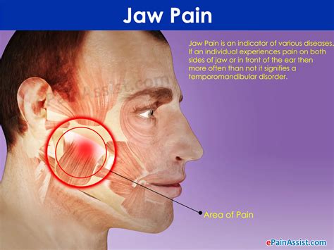 Earache And Jaw Pain When Chewing Herbs And Food Recipes