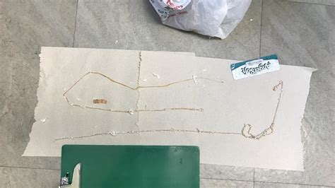 Man Pulls 5 12 Foot Long Tapeworm Out Of His Body Blames Sushi Habit