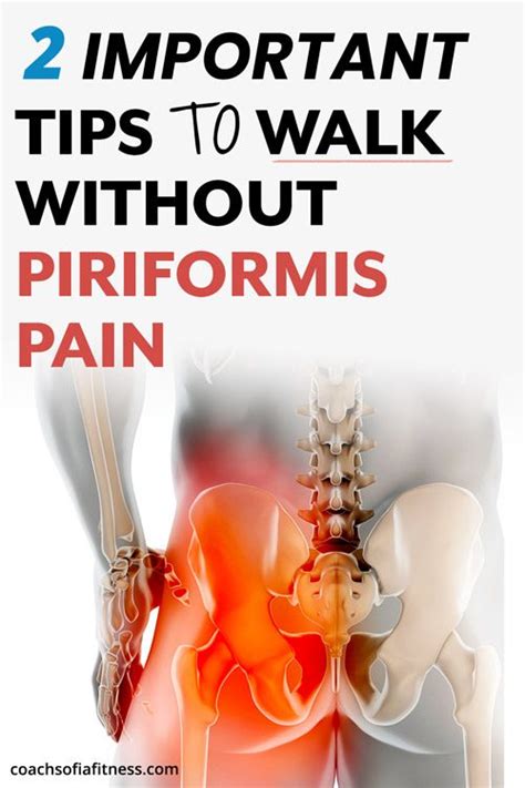 How To Minimize Pain Walking Piriformis Syndrome Sciatica Coach