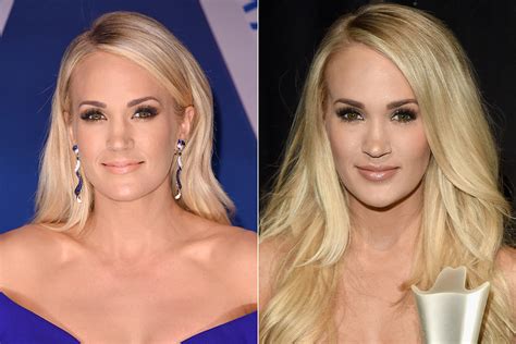 6 Months After Accident Carrie Underwood Is Still Beautiful