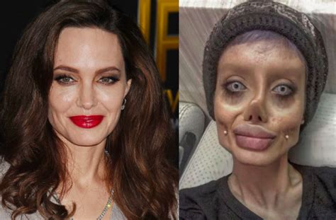 Woman Claims She Underwent 50 Plastic Surgeries To Look Like Angelina Jolie