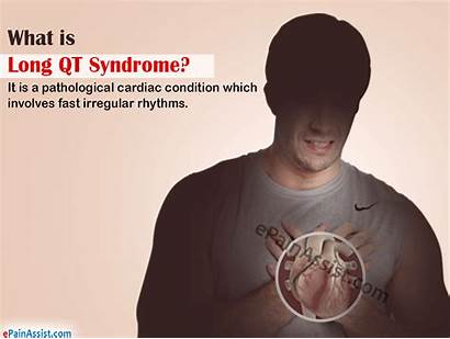 Qt Syndrome Symptoms Heart Causes Treatment Pain