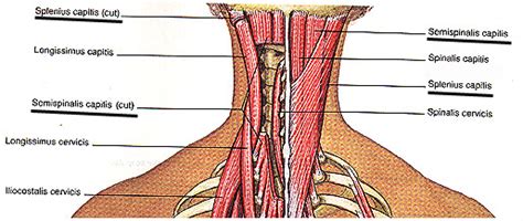 Dowager's hump is an outward curvature of the thoracic vertebrae of the upper back. Muscles of the Human Body