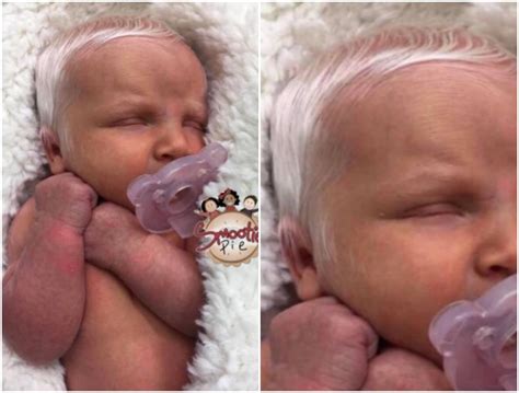 Amazing Stories Around The World Doctors Explains Why Baby Was Born With Head Full Of Grey Hair