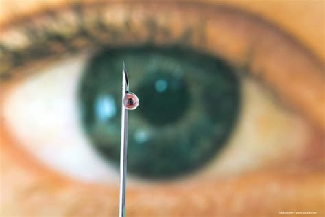 From Intravitreal Injections To Gene Therapy New Amd Treatments Are On
