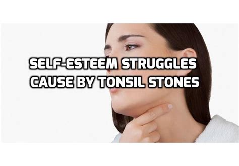Self Esteem Issues From Tonsil Stones And How To Cope Anti Aging