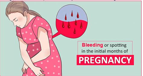 Vaginal Bleeding In Early Pregnancy Top 20 Remedies Home Remedies