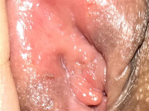 I Feel Like My Vagina Opening Doesnt Look Normal Picture Sexual