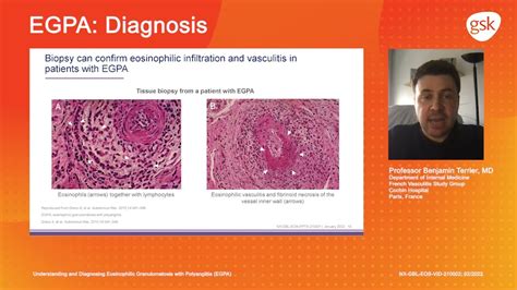 Diagnosis Understanding And Diagnosing Eosinophilic Granulomatosis