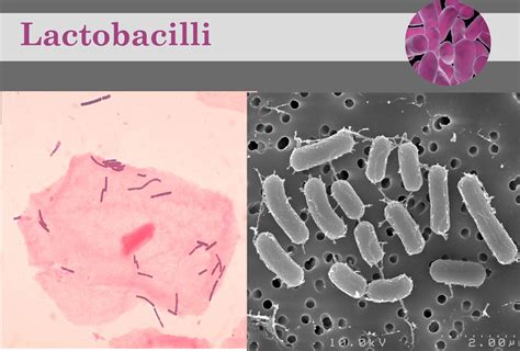Lactobacillus Galnet Wiki Fandom Powered By Wikia