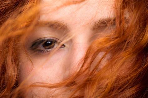 Redheads Do You Have These Other Recessive Genes H2bar