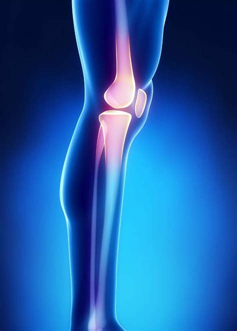 What Is Patellofemoral Pain Syndrome Moyer Total Wellness
