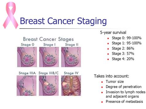 Four Stages Of Breast Cancer Custom Academic