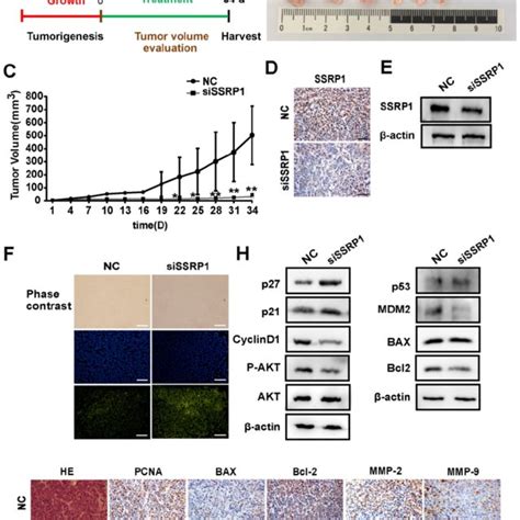 ssrp1 inhibition represses proliferation of colorectal cancer cells download scientific