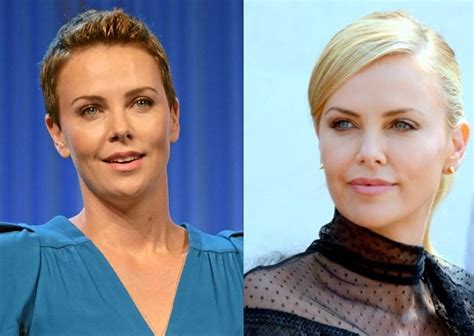 Charlize Theron Before And After Plastic Surgery