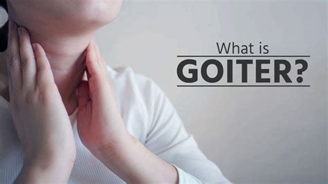 What Is Goiter What Is Goiter Disease What Is Goiter Thyroid