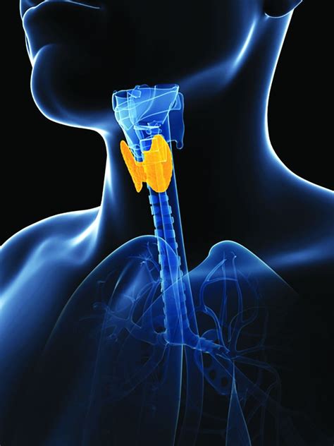 20 With Cancer On Checkpoint Inhibitors Get Thyroid Dysfunction