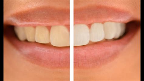 How To Whiten Teeth In Photoshop And Make A Picture Look Better